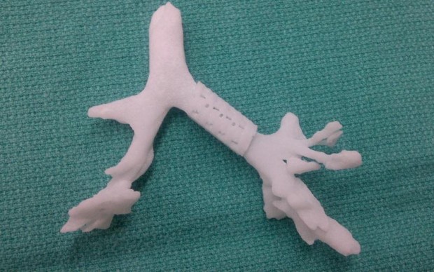 Das Implantat auf einem Modell der Hauptbronchie des Kindes (Bild: Uni Michigan)